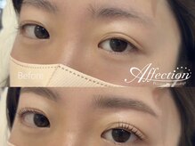 アフェクション アイビューティー(Affection eye beauty)