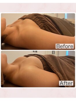 ビジョイ(Bejoy)/バストコース　BeforeAfter