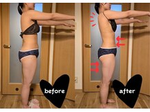 ヨサパーク ラリマー(YOSA PARK Larimar)/ビフォーアフター20代