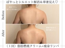 アルム(ALUM)/背中ケアは30分¥4000～ご案内(^^