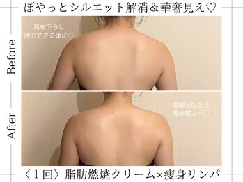 アルム(ALUM)/背中ケアは30分¥4000～ご案内(^^