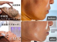 ユウビジン(YOU美人)/