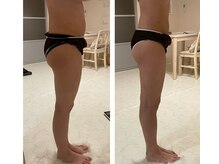 ヨサパーク フェリニタ(YOSA PARK felinita)/BeforeAfter