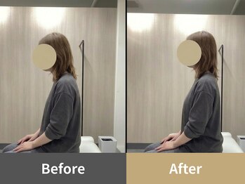 クオーレ(Cuore)/Before After