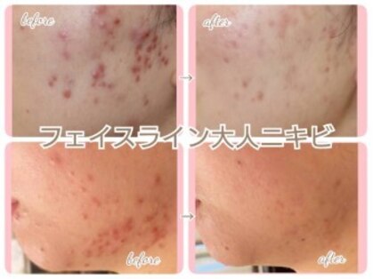 キッカ 梅田天六(Kikka)の写真