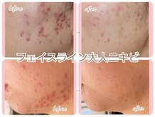キッカ 梅田天六(Kikka)