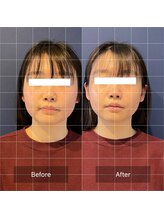 フフラ KANコルギセラピー山梨本店(fufla)/【コルギ小顔ソムリエ】小顔矯正