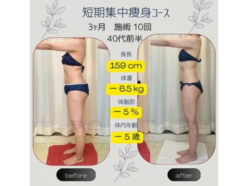 ティアエ(T-ae)/本気ヤセ【短期集中痩身コース】