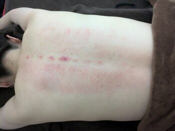 リデザイン 京都(REDESIGN)/REDESIGN京都中医施術法