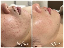 シーラックス(Sealax)/長年のお悩みにしっかり寄り添う