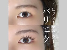 エトワールビューティー(ETOILE BEAUTY)