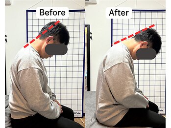 整体院 爽良/【札幌/大通り】首肩こりに特化