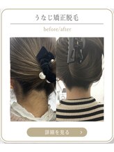 ミース 上野店/えりあし脱毛が人気！