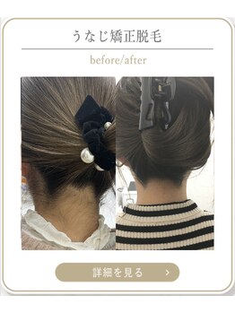 ミース 上野店/えりあし脱毛が人気!