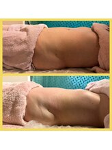 ビューティートワブルームサロン(Beauty Towabloom Salon)/一回でお腹ぺったんこ！