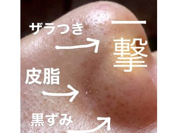 ジプソフィラフィフティドット(gypsophira15.)/施術