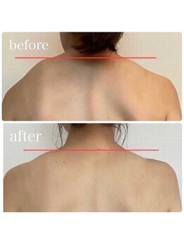 カレント(current)/筋膜リリース《全身》¥10500