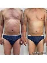 リリーローズ(LilyRose)/おなかやせ