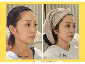 アン 銀座(ann)/レモンボトル