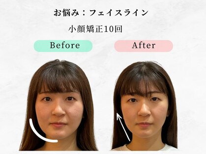 美容整体ウェリナ 中川八田院の写真