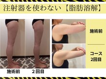 クリニカルエステ イーズ イオンモール筑紫野店の雰囲気（レモンボトル6cc導入×リンパで、落ちにくい二の腕もスッキリ）