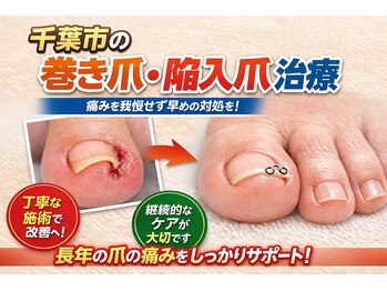 巻き爪じゅん 船橋店/普通に見えて危険な陥入爪の実態