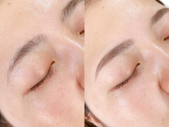ホワイトアイ 横浜(WHITE EYE)の写真/【美眉アイブロウ+フェイスWAX(額orフェイスライン)】古い角質を落としワントーンUPした美肌に!!