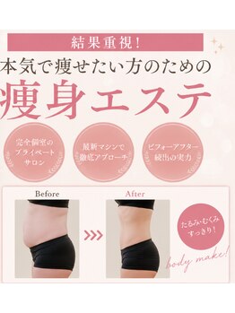 ステラ(Stella)の写真/気になるお腹・脚・背中を集中ケア！理想のサイズダウンへ