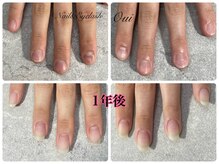 ウイ(Oui)/自爪、深爪育成