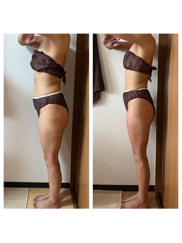 キラ(KIRA)/変化に驚く痩身メニュー！