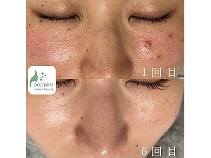 メゾンビューティーポピンズ 恵比寿(maisonbeauty poppins)の写真