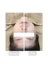 トランク(Trunk)/エアバリ♪before→after