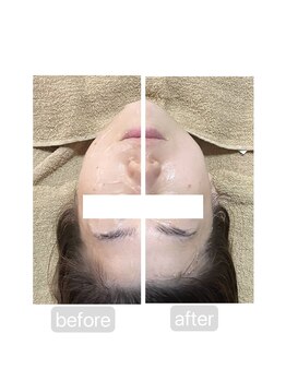 トランク(Trunk)/エアバリ♪before→after