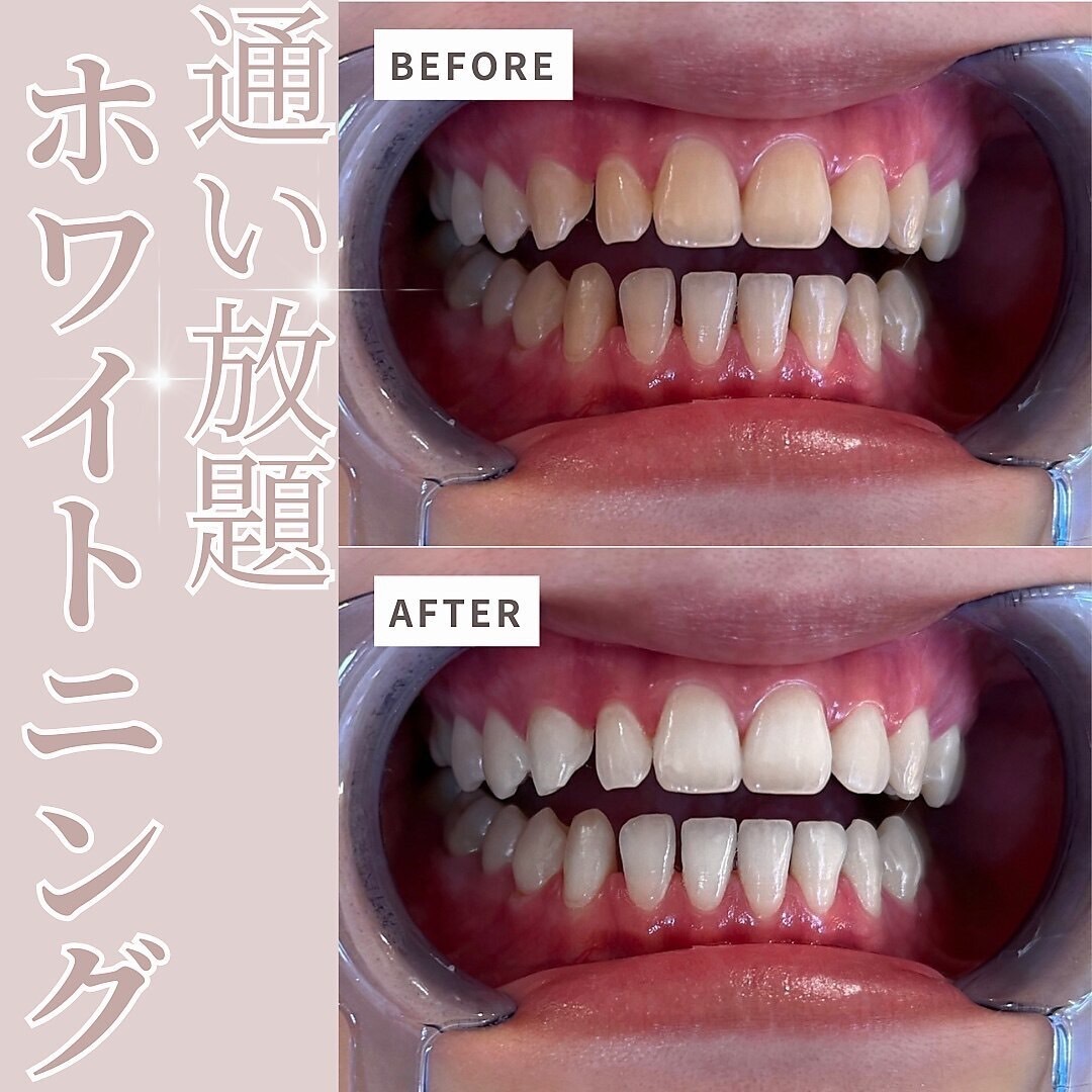 エクシアホワイト 山形西バイパス店/ビフォーアフター