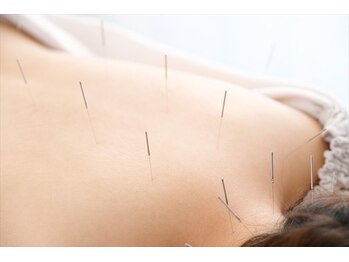 青葉台駅前整骨院/ツボ施術