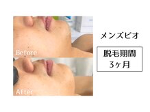 メンズビオ 神戸三宮店/