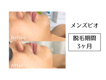 メンズビオ 神戸三宮店/