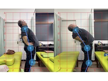 整骨院こころ 祇園院/可動域の変化