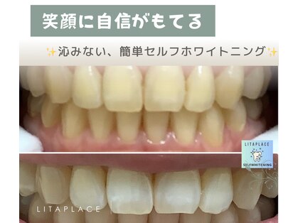 リタプレイス 琴似(LITAPLACE)の写真