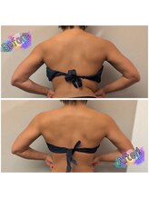 バーン 長崎 諫早(BURN)/ハイパーナイフカット出し