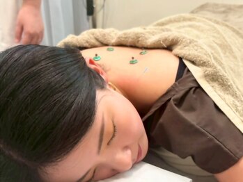 グリーン 京都烏丸店(green)の写真/ウィンターキャンペーン中♪【女性のための優しい鍼灸整体 60分¥1980】首・肩こり、ホルモンの乱れ改善