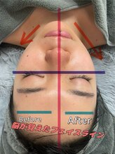 アネム(Anemu lune)/脳が思い出す位置へ