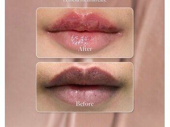 ラリュール(L'ALLURE)/LEMELLA★韓国発LEMELLA