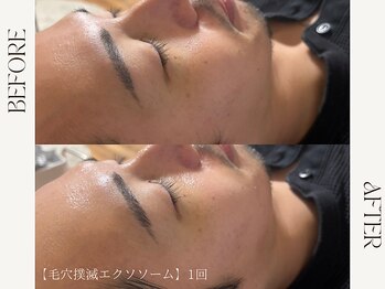 ルカ 北堀江(Luca)/ハリ、ツヤが欲しい方はこれ☆