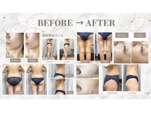 FJの雰囲気（Befor After随時更新中！詳しくはフォトギャラリーをチェック♪）