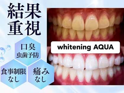 ホワイトニングサロン ホワイト(WHITE)の写真