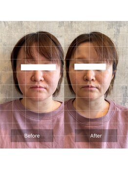 フフラ KANコルギセラピー山梨本店(fufla)/小顔ソムリエ　小顔