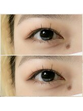 アイネイル 小倉(ai nail)/ワンホンデザイン