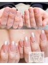 爪のコンプレックス解消