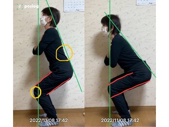 エヴォストレッチ(EVO STRETCH)/70代女性【腰痛、膝痛】